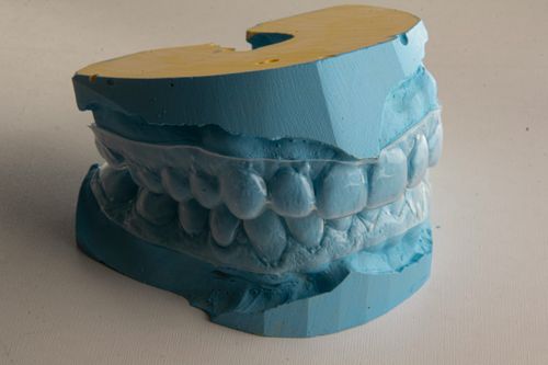 improved bite for easier chewing and speaking