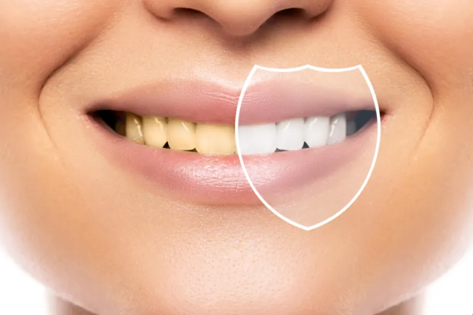 benefits of teeth whitening