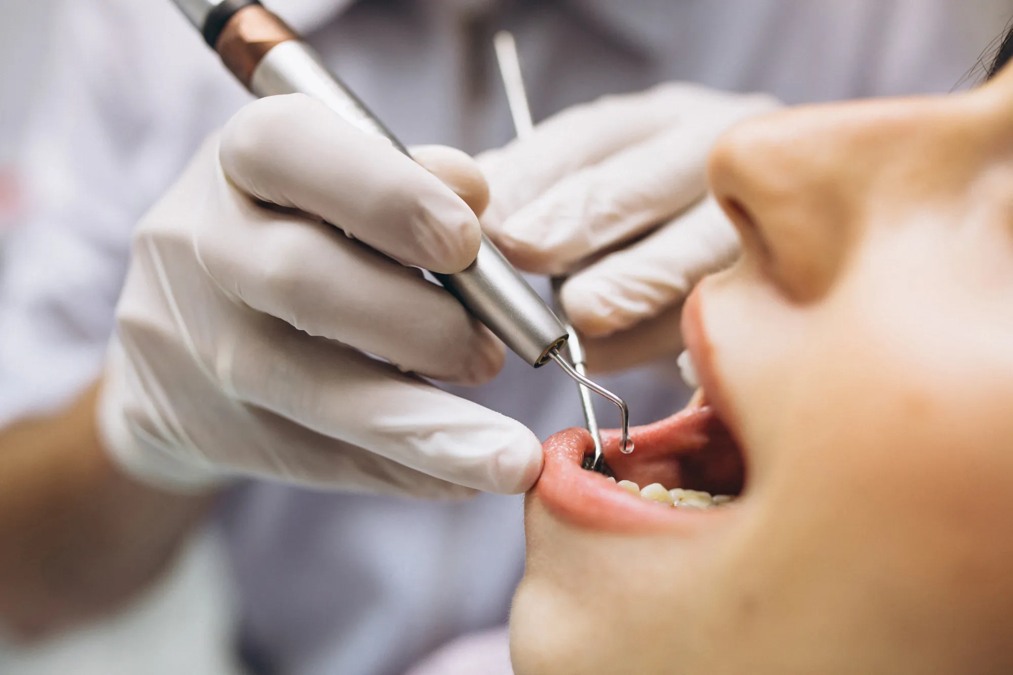 root canal saves natural tooth